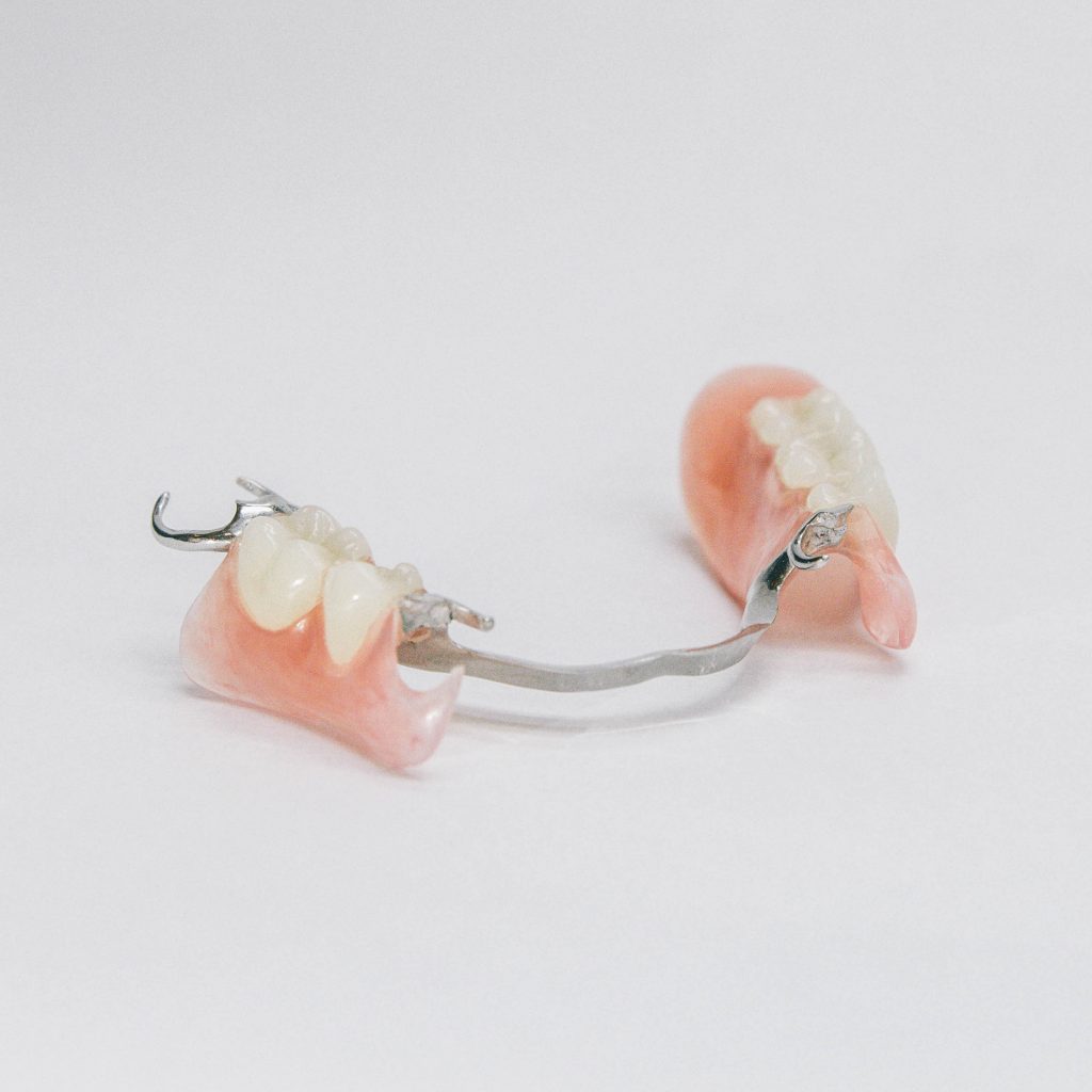 Lower Cast Metal Partial Denture with Valplast Invisible Clasps