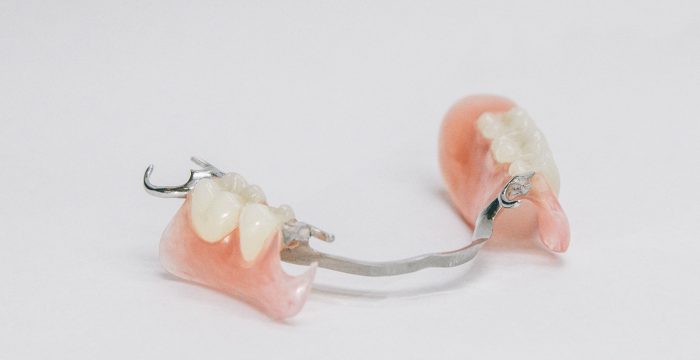 Lower Partial Denture with Valplast Clasps