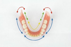 Lower Suction Denture Diagram