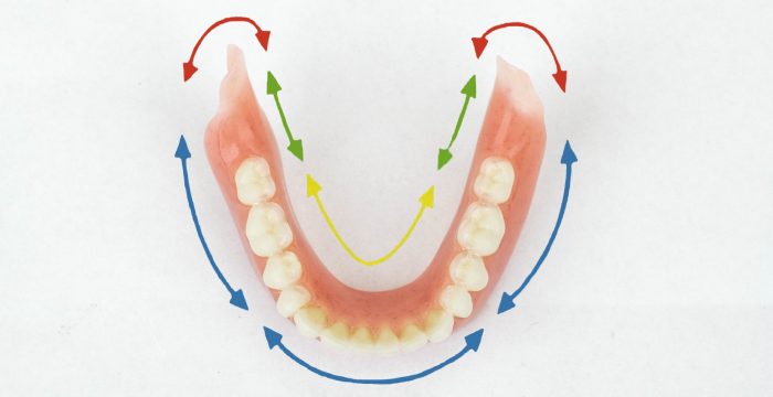 Lower Suction Denture Diagram